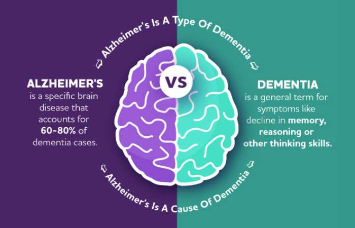  What's the difference between Alzheimer's and madness?